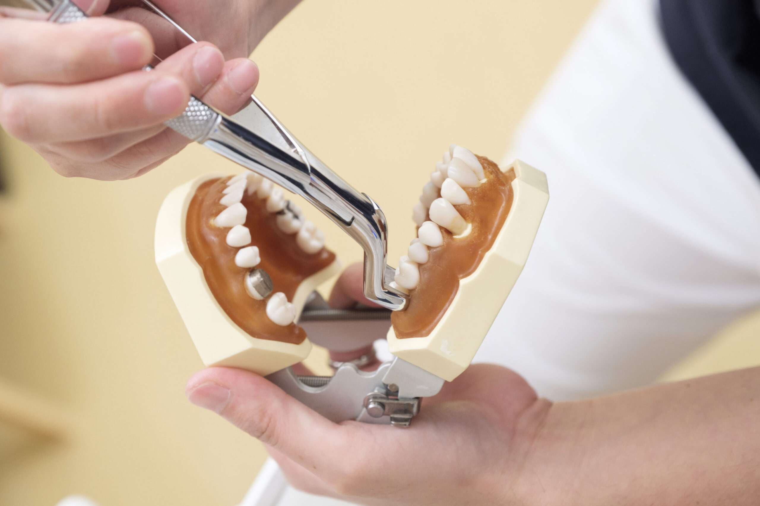 Tooth Extraction at a Japanese Dentist's Office