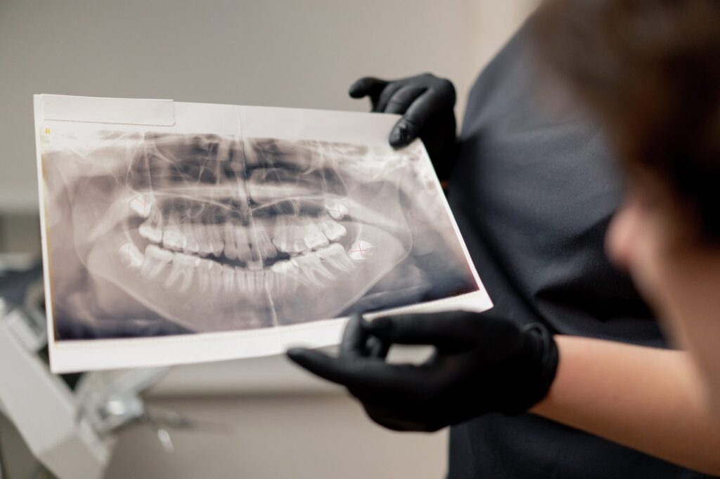X-rays of a the mouth of a patient at Q Smies Dentistry