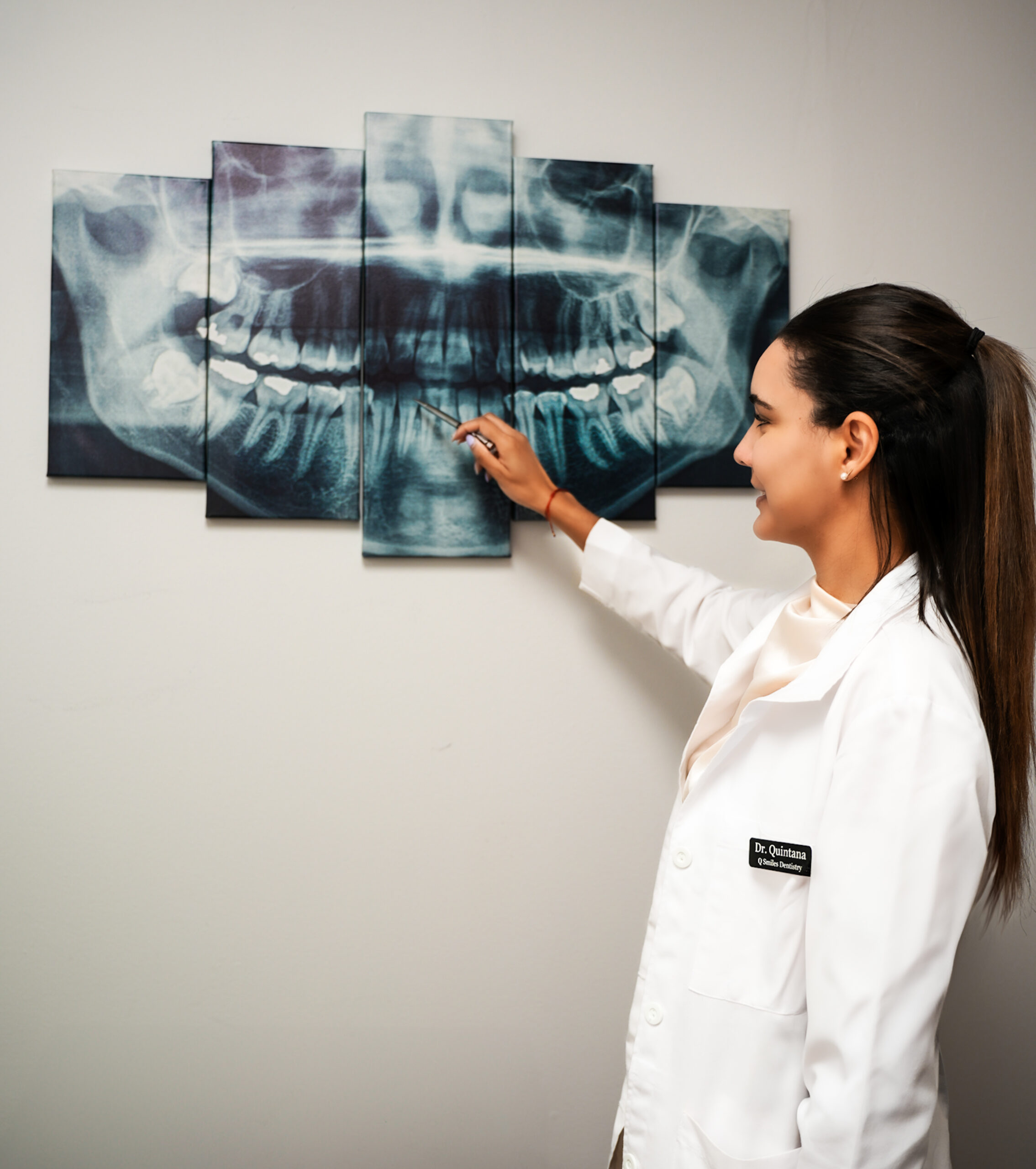 Dr. Showing X-Ray - Q Smiles Dentistry - Implant & Cosmetic Dentistry in North Miami Beach